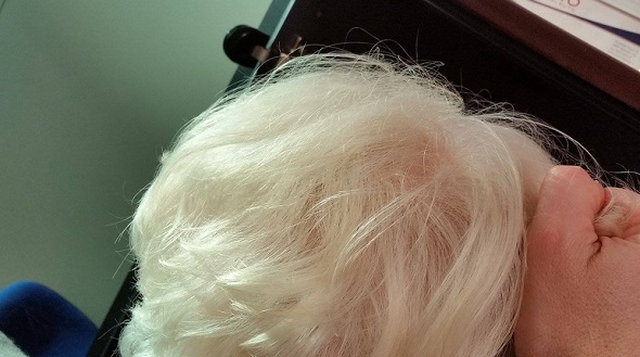 lite capelli strappati